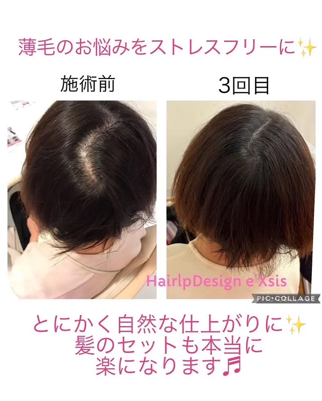カウンセリング資料と肌状態を確認する手元の写真