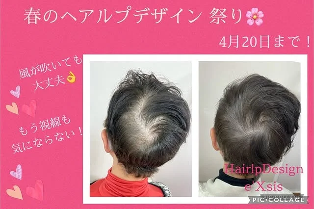 施術ベッドの横にタオルと美容機器が整えられた個室の内観